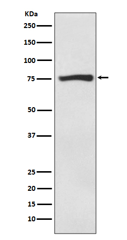 1 - Anti-ACSS2/Acetyl Coa Synthetase Rabbit Monoclonal Antibody ABO13722