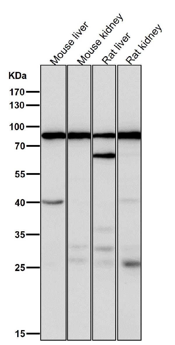 1 - Anti-ACSS2/Acetyl Coa Synthetase Rabbit Monoclonal Antibody ABO13722