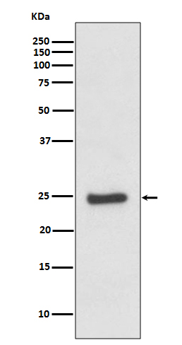 1 - Anti-ZNRF2 Rabbit Monoclonal Antibody ABO13723