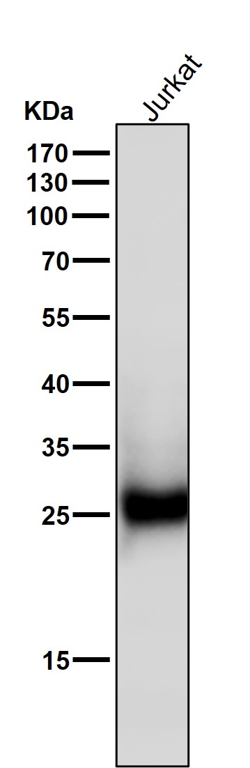 1 - Anti-ZNRF2 Rabbit Monoclonal Antibody ABO13723
