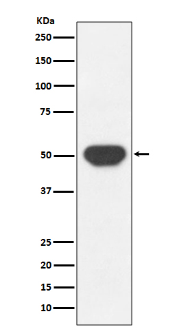 1 - Anti-PTP1B PTPN1 Rabbit Monoclonal Antibody ABO13725