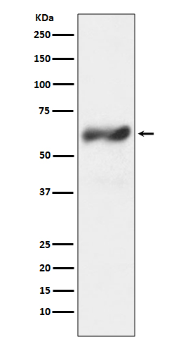 1 - Anti-c-Fos Rabbit Monoclonal Antibody ABO13726