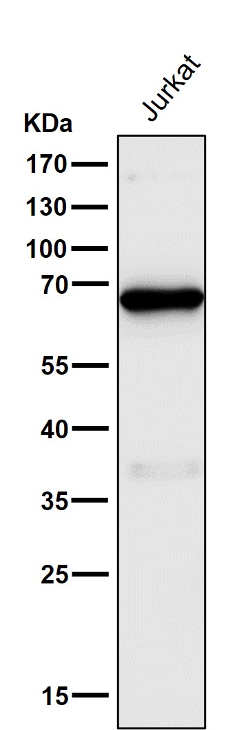 1 - Anti-c-Fos Rabbit Monoclonal Antibody ABO13726