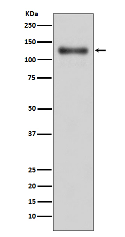 1 - Anti-LAMP1/Cd107A Rabbit Monoclonal Antibody ABO13727