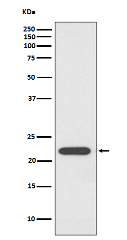 1 - Anti-PRDX1/Peroxiredoxin 1 Rabbit Monoclonal Antibody ABO13728