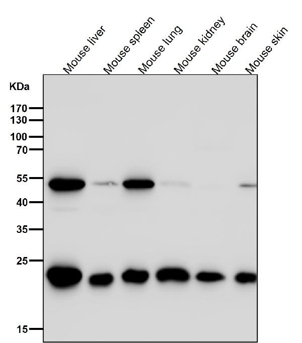 1 - Anti-PRDX1/Peroxiredoxin 1 Rabbit Monoclonal Antibody ABO13728