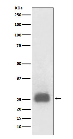 1 - Anti-TIMP1 Rabbit Monoclonal Antibody ABO13730