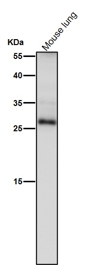 1 - Anti-TIMP1 Rabbit Monoclonal Antibody ABO13730