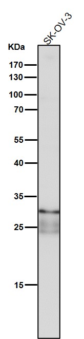 1 - Anti-TIMP1 Rabbit Monoclonal Antibody ABO13730