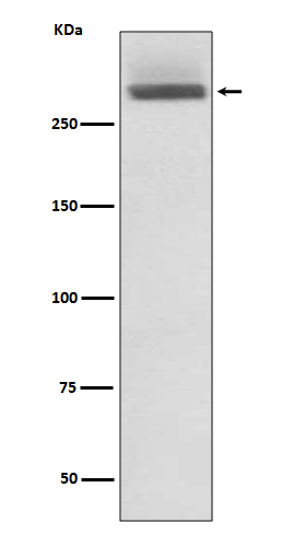 1 - Anti-LAMA3/Laminin 5 Rabbit Monoclonal Antibody ABO13731