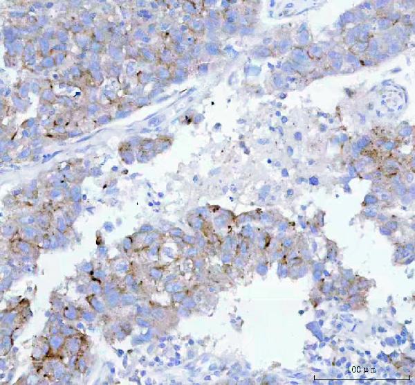 2 - Anti-VAMP8/Endobrevin Rabbit Monoclonal Antibody ABO13734