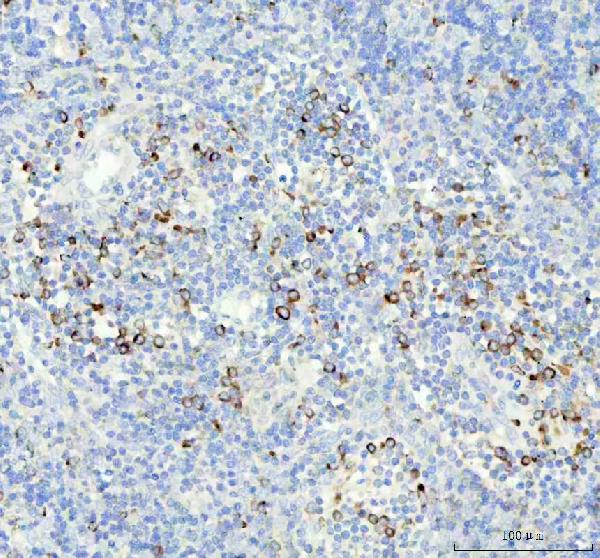 2 - Anti-VAMP8/Endobrevin Rabbit Monoclonal Antibody ABO13734