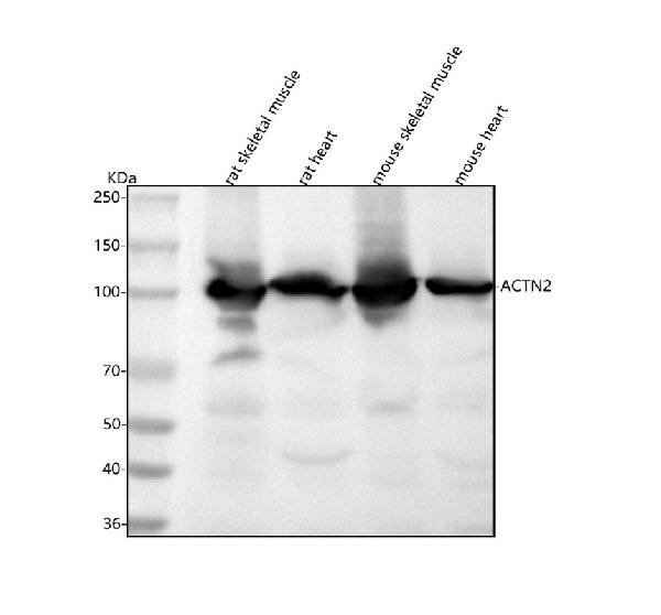 1 - Anti-ACTN2 Rabbit Monoclonal Antibody ABO13737