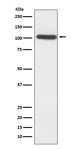 1 - Anti-ACTN2 Rabbit Monoclonal Antibody ABO13737