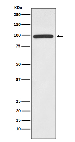 1 - Anti-HMGCR/Hmg Coa Reductase Rabbit Monoclonal Antibody ABO13738