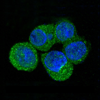 3 - Anti-S100P Rabbit Monoclonal Antibody ABO13739
