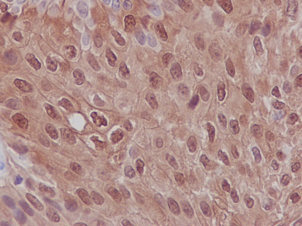 2 - Anti-S100P Rabbit Monoclonal Antibody ABO13739
