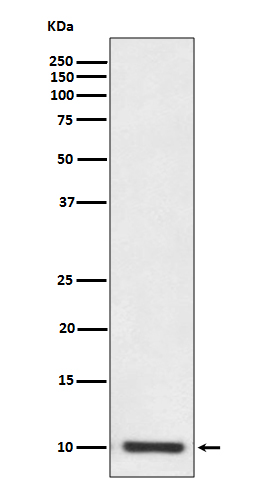 1 - Anti-S100P Rabbit Monoclonal Antibody ABO13739
