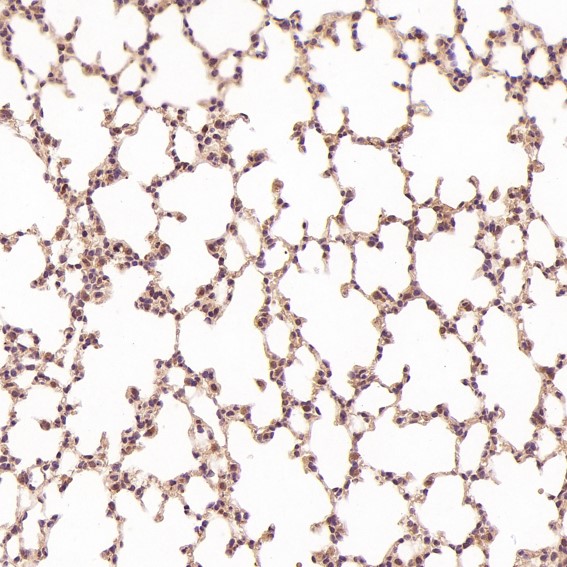 2 - Anti-Dnmt1 Rabbit Monoclonal Antibody ABO13740