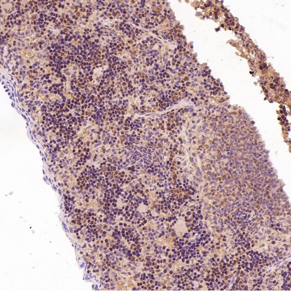 2 - Anti-Dnmt1 Rabbit Monoclonal Antibody ABO13740