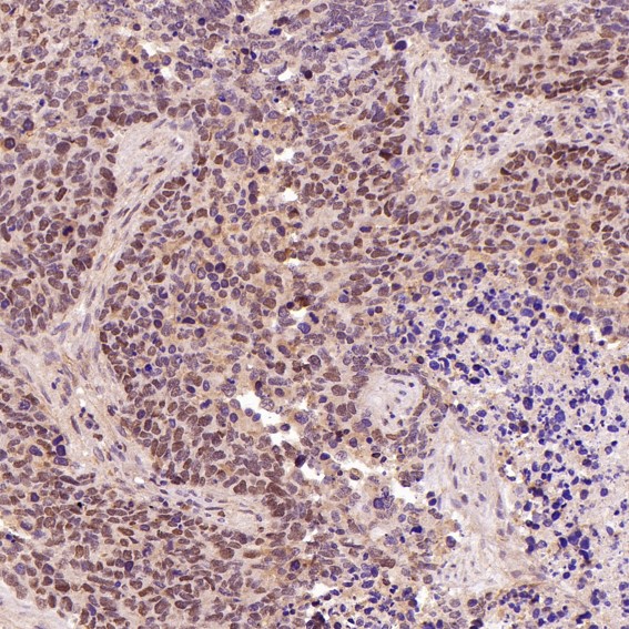 2 - Anti-Dnmt1 Rabbit Monoclonal Antibody ABO13740