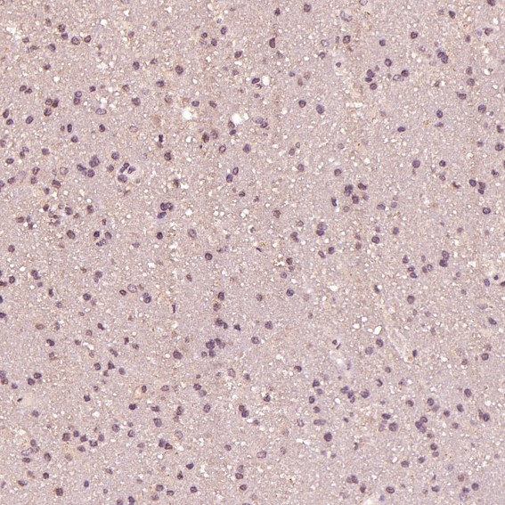 2 - Anti-Dnmt1 Rabbit Monoclonal Antibody ABO13740