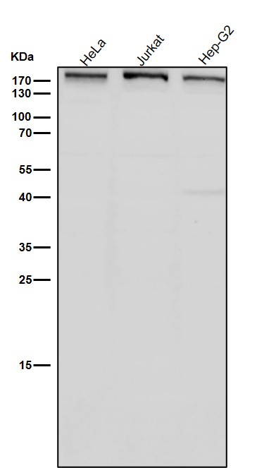 1 - Anti-Dnmt1 Rabbit Monoclonal Antibody ABO13740