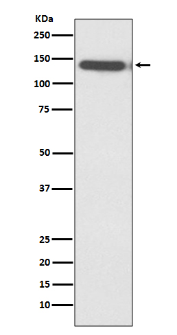 1 - Anti-Ctip2 Rabbit Monoclonal Antibody ABO13741