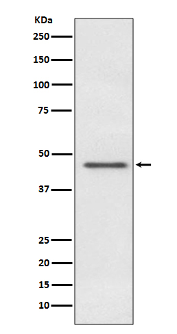 1 - Anti-PDHA1/Pdh E1Alpha Rabbit Monoclonal Antibody ABO13743