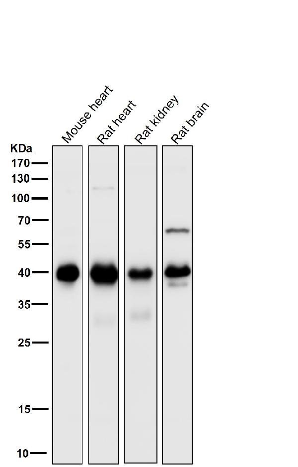 1 - Anti-PDHA1/Pdh E1Alpha Rabbit Monoclonal Antibody ABO13743