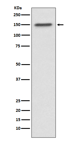 1 - Anti-ASPP2 Rabbit Monoclonal Antibody ABO13744