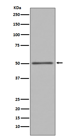 1 - Anti-FOXA1/Hnf 3 Alpha Rabbit Monoclonal Antibody ABO13745