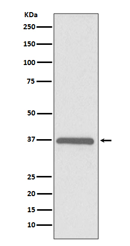1 - Anti-ERCC1 Rabbit Monoclonal Antibody ABO13746