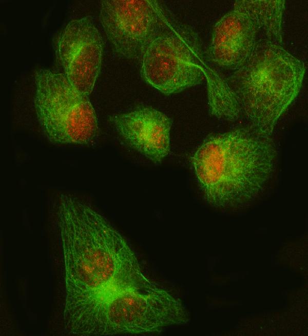 3 - Anti-FOXP1 Rabbit Monoclonal Antibody ABO13747