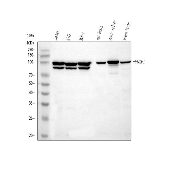 1 - Anti-FOXP1 Rabbit Monoclonal Antibody ABO13747