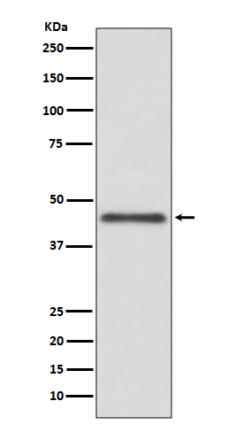 1 - Anti-HLA G Rabbit Monoclonal Antibody ABO13750