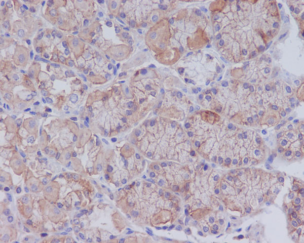 2 - Anti-CD147 BSG Rabbit Monoclonal Antibody ABO13753