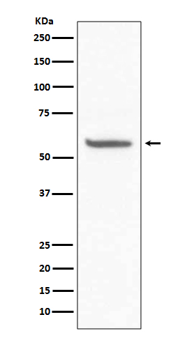 1 - Anti-CD147 BSG Rabbit Monoclonal Antibody ABO13753