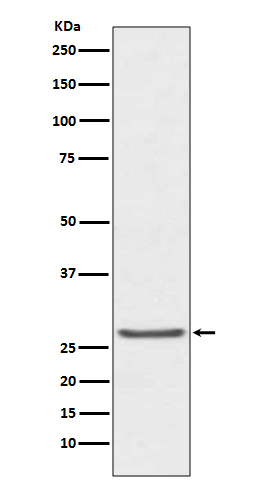 1 - Anti-TIMP1 Rabbit Monoclonal Antibody ABO13754