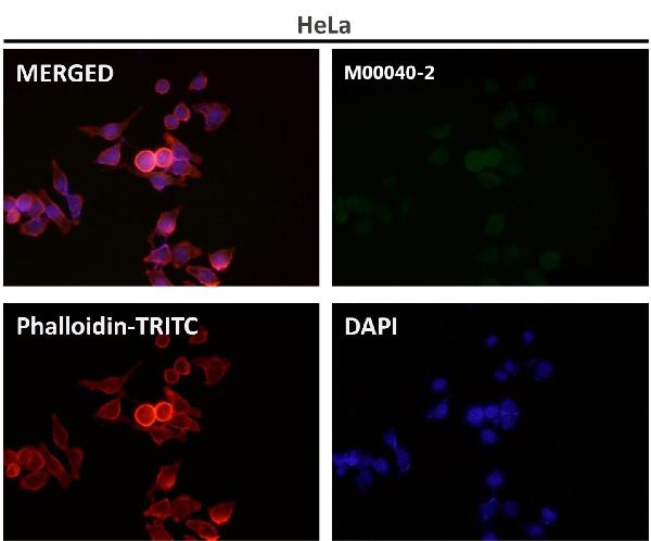 1 - Anti-Bcl-2 Rabbit Monoclonal Antibody ABO13757