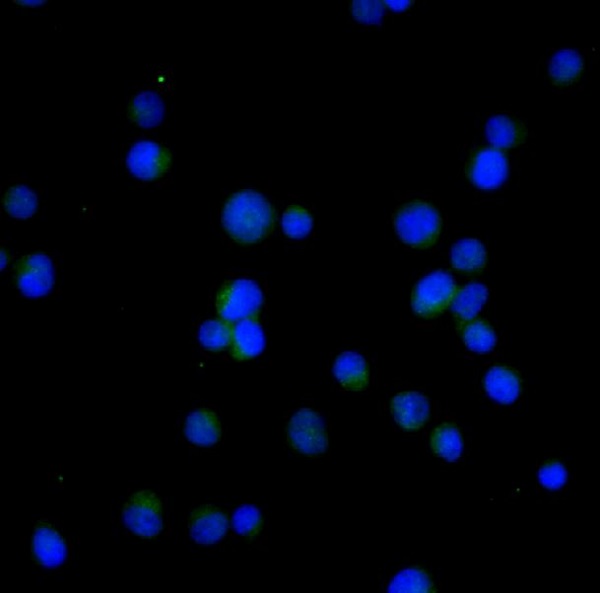 3 - Anti-Bcl-2 Rabbit Monoclonal Antibody ABO13757