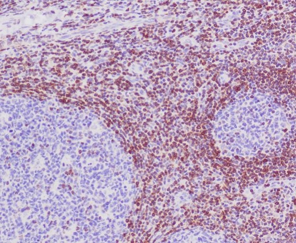 2 - Anti-Bcl-2 Rabbit Monoclonal Antibody ABO13757