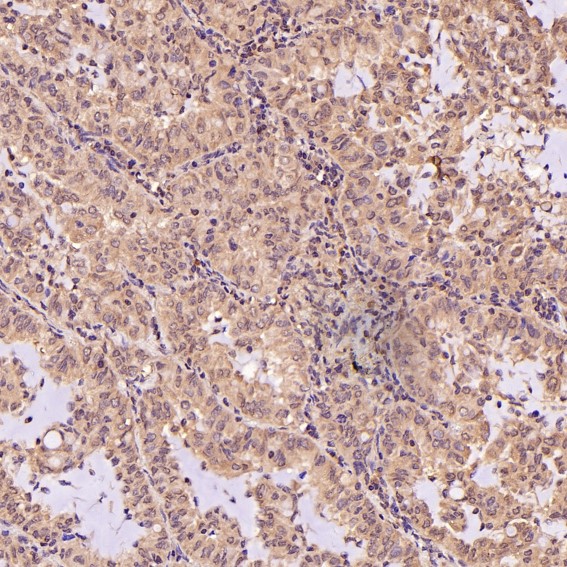 2 - Anti-Bcl-2 Rabbit Monoclonal Antibody ABO13757