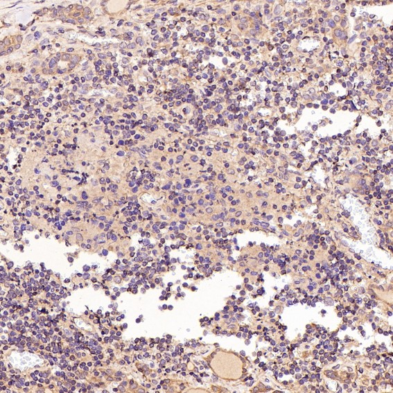 2 - Anti-Bcl-2 Rabbit Monoclonal Antibody ABO13757