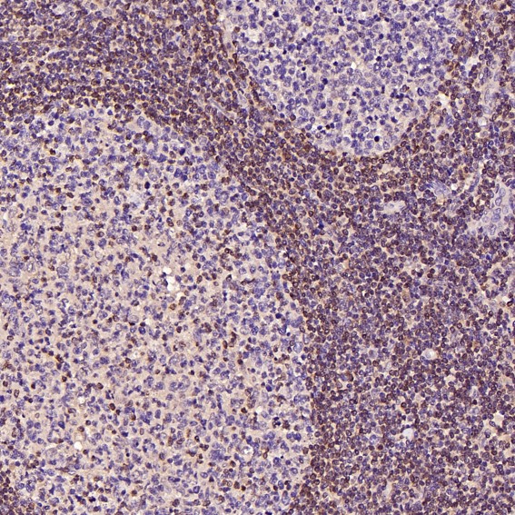 2 - Anti-Bcl-2 Rabbit Monoclonal Antibody ABO13757