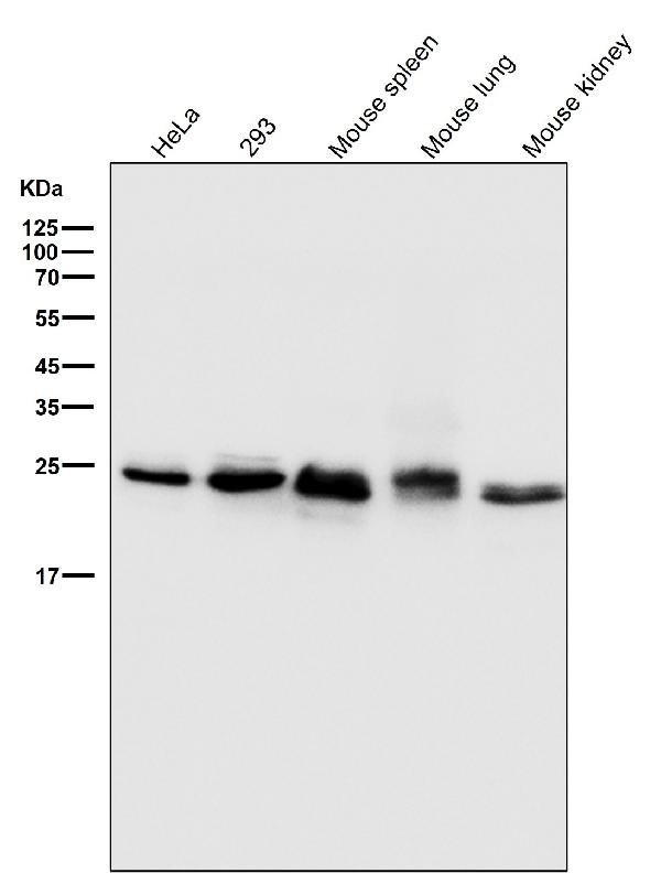 1 - Anti-Bcl-2 Rabbit Monoclonal Antibody ABO13757