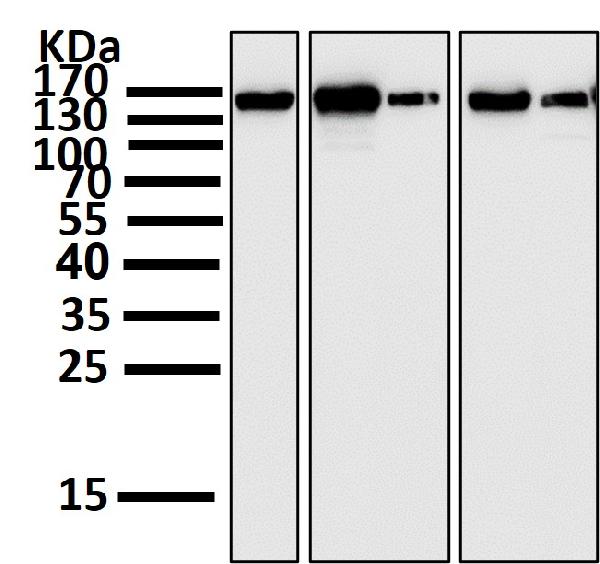 1 - Anti-FGFR2 Rabbit Monoclonal Antibody ABO13758