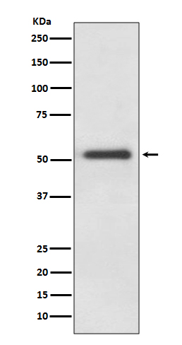 1 - Anti-FOXA2/Hnf3B Rabbit Monoclonal Antibody ABO13760
