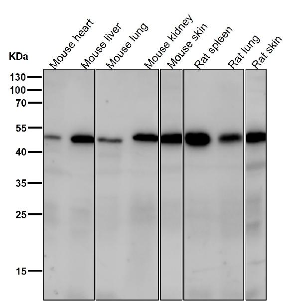 1 - Anti-FOXA2/Hnf3B Rabbit Monoclonal Antibody ABO13760