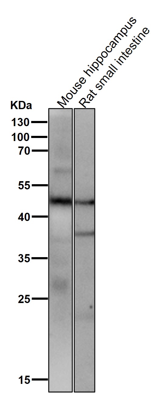 1 - Anti-FOXA2/Hnf3B Rabbit Monoclonal Antibody ABO13760